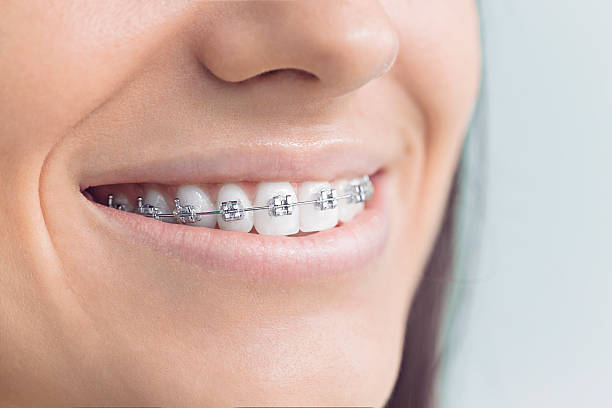 Best Invisalign and Clear Aligners  in Fort Lee, NJ